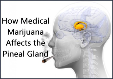 MEDICAL MARIJUANA FOR THE PINEAL GLAND
